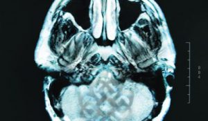 Breaking Benjamin — Dear Agony