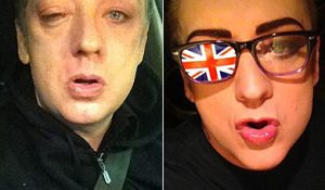 ФОТО ДНЯ: Бой Джордж получил в глаз от фанатки